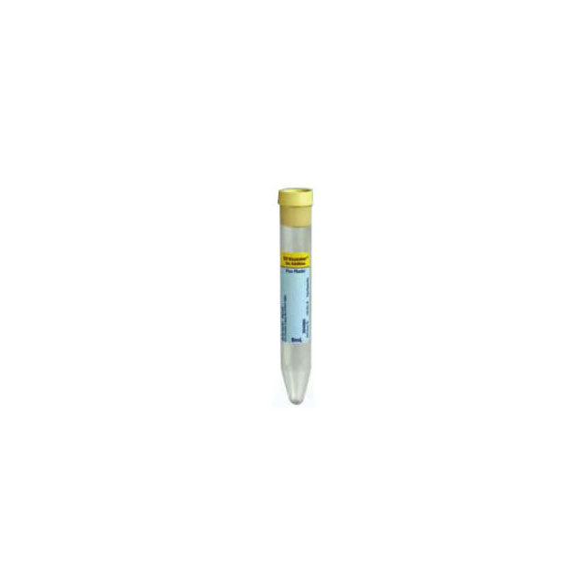 Vacutainer Plus Urinalysis Tube